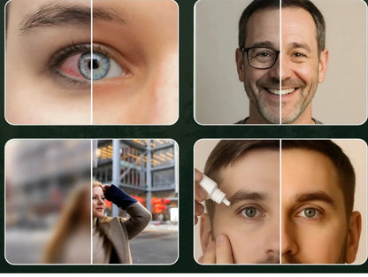 Clario™ - Advanced Vision Complex